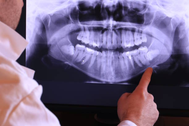 Best Pediatric Emergency Dentist in Rancho Cumonga, CA